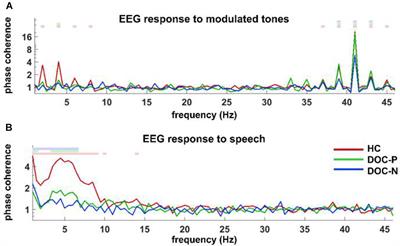 Neural Tracking of Sound Rhythms Correlates With Diagnosis, Severity, and Prognosis of Disorders of Consciousness